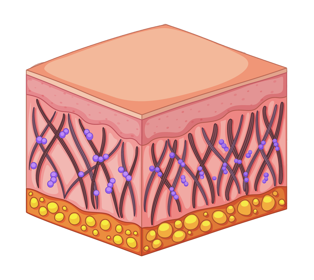 Skin-Wrinkles-After-4