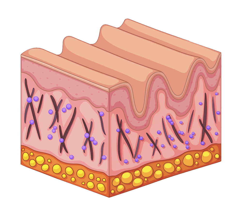 Skin-Wrinkles-Before-4